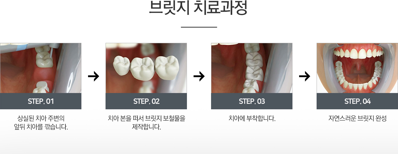 �긴��