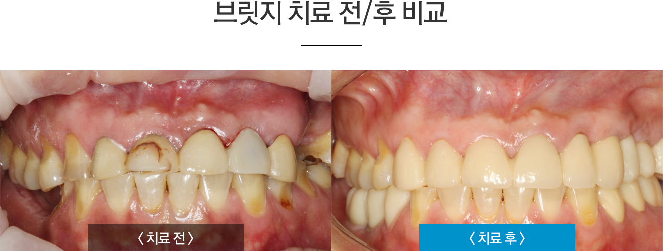 �긴��