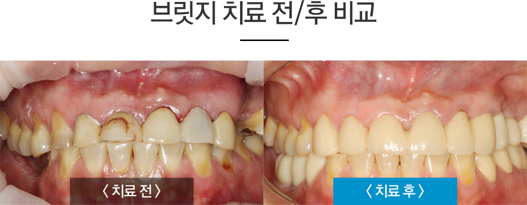 �긴��