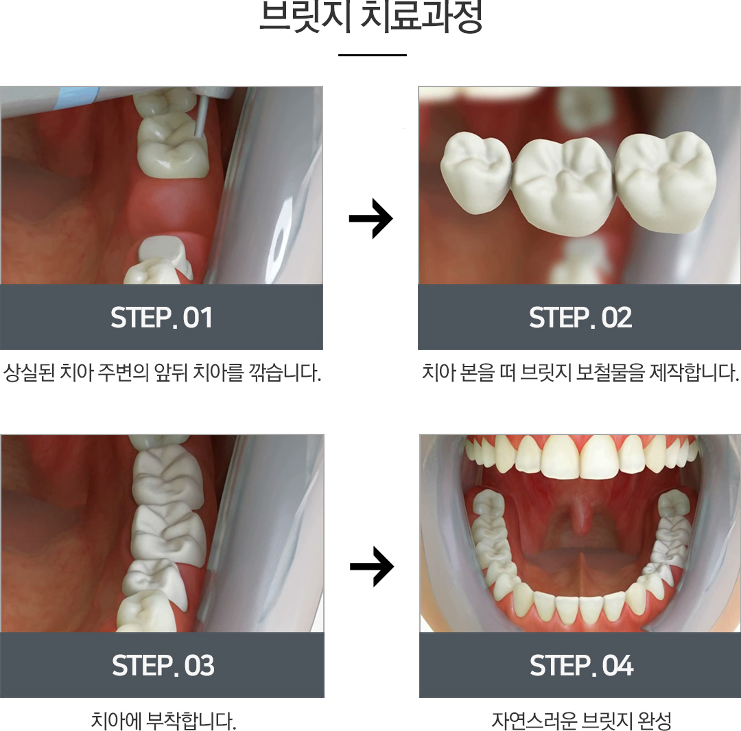 �긴��